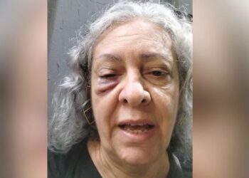 Cantora gospel de 62 anos é agredida com soco em evangelismo