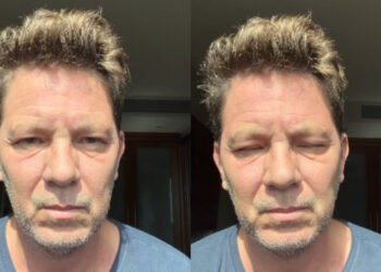 Mario Frias relata “visita da morte” após ficar na UTI, até Deus agir