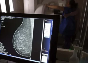 ANS defende que plano cubra mamografia digital sem restrição de idade