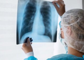 Diagnóstico tardio dá poucas chances de cura para o câncer de pulmão