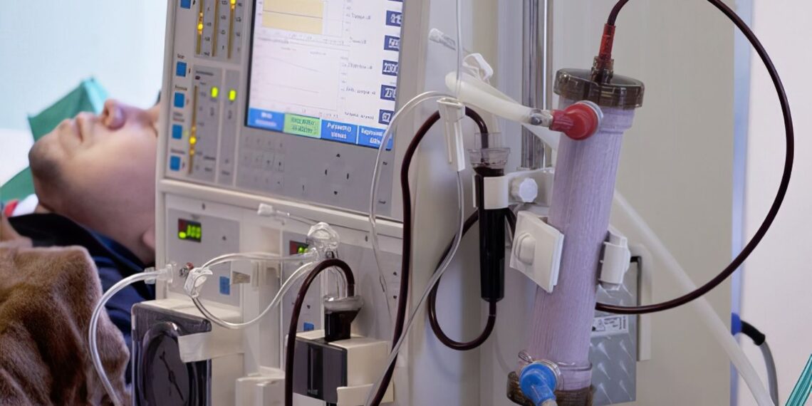 Estudo alerta para subdiagnóstico da doença renal crônica no Brasil