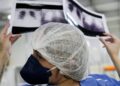 Diagnóstico tardio dá poucas chances de cura do câncer de pulmão