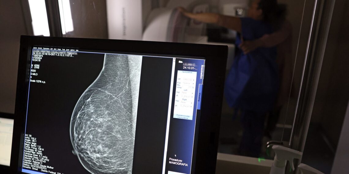 Plano de saúde terá que cobrir mamografia digital para todas as idades