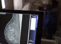 Plano de saúde terá que cobrir mamografia digital para todas as idades