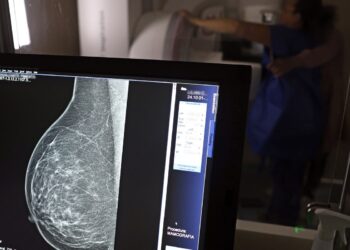Plano de saúde terá que cobrir mamografia digital para todas as idades