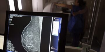 Plano de saúde terá que cobrir mamografia digital para todas as idades