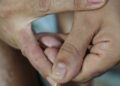 Dermatite atópica impacta pele, sono e autoestima: saiba como tratar